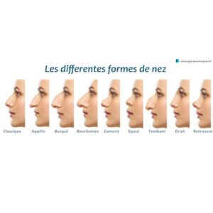 formes nez rhinoplastie