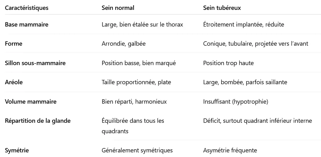 caractéristiques des seins tubéreux