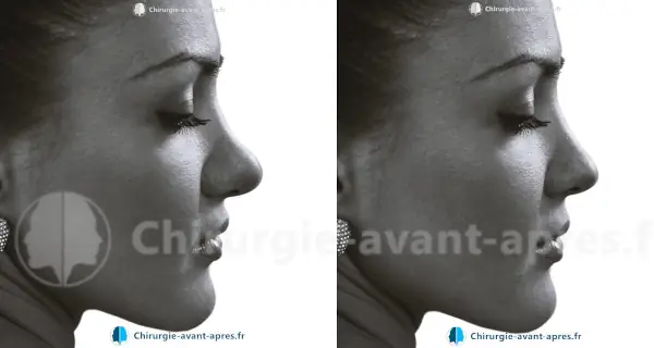 chirurgien nez lille